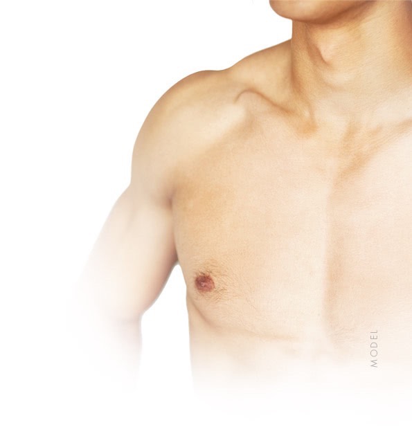 model male breast reduction little rock