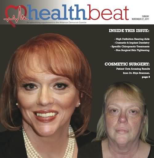 Health Beat November 2011