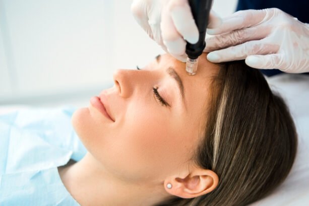 Young Woman Getting Microneedling Treatment from a Licensed Aesthetician 