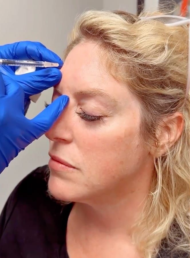 Little Rock Botox injections