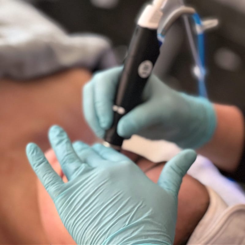Little Rock hydrafacial treatment