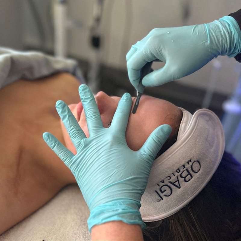 Professional dermaplaning in Little Rock